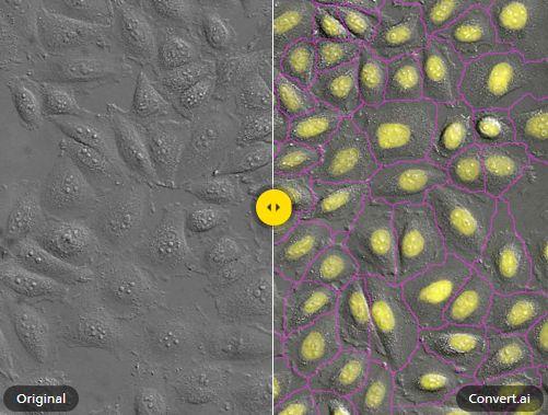 Artifical Intelligence for Predictive Imaging