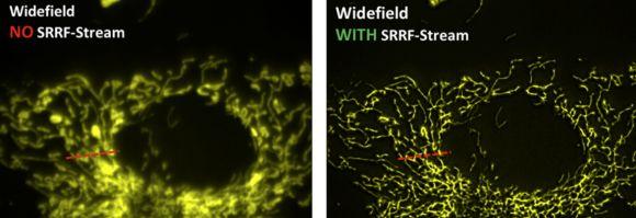 Webinar : Andor SRRF and TIRF Microscopy