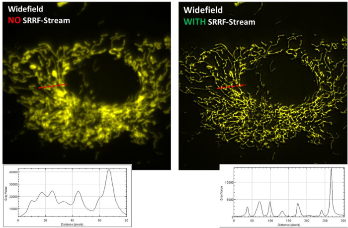Andor SRRF-Stream+ Super-Resolution Software